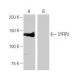 CYFIP2 Antibody (6-YD16) - Western Blotting - Image 64902