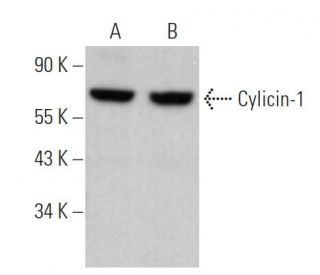 Cylicin-1 Antibody (B-8) - Western Blotting - Image 368384 