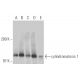 cylindromatosis 1 Antibody (E-4) - Western Blotting - Image 15695 