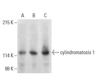 cylindromatosis 1 Antibody (E-4) - Western Blotting - Image 399131 
