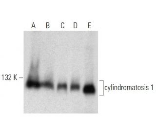 western blotting image from recommended cylindromatosis 1 (H-6) monoclonal antibody replacement. Image 320926