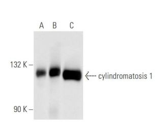 cylindromatosis 1 Antibody (H-6) - Western Blotting - Image 58295