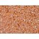 CYP11B1 Antibody (A-11) - Immunohistochemistry - Image 377183