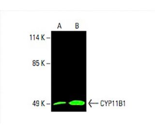 CYP11B1 Antibody (H-11) - Western Blotting - Image 394713 