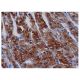 immunohistochemistry image from recommended CYP17A1 (D-12) monoclonal antibody replacement. Image 350189