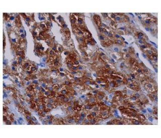 immunohistochemistry image from recommended CYP17A1 (D-12) monoclonal antibody replacement. Image 350189