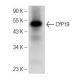 western blotting image from recommended CYP19 (E-9) monoclonal antibody replacement. Image 148977