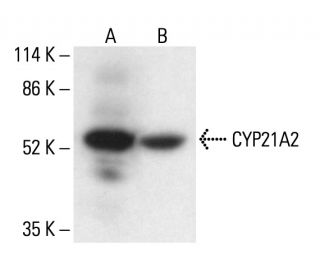 CYP21A2 Antibody (B-7) - Western Blotting - Image 411310Each CRISPR/Cas9 Knockout (KO) Plasmid product consists of a pool of 3 plasmids designed to ensure identification and cleavage of a specific gene for maximum knockout efficiency. Each plasmid encodes a unique 20 nt sequence derived from the GeCKO (v2) library.