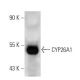 CYP26A1 Antibody (F27 P6 A1) - Western Blotting - Image 14616 