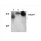 CYP26A1 Antibody (F27 P6 A1) - Western Blotting - Image 392599