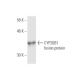 CYP26B1 Antibody (2G7) - Western Blotting - Image 350237