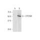 CYP26B1 Antibody (2G7) - Western Blotting - Image 352200 