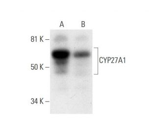 CYP27A1 Antibody (D-12) - Western Blotting - Image 293040 
