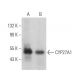 CYP27A1 Antibody (D-12) - Western Blotting - Image 363835 