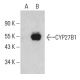 CYP27B1 Antibody (E-7) - Western Blotting - Image 396625 