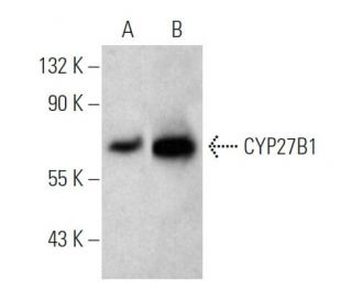 CYP27B1 Antibody (G-5) - Western Blotting - Image 374537SAM Transcription Activation: SAM system utilizing dCas9-VP64, MS2-P65-HSF1, and sgRNA for precise gene transcription activation. 
