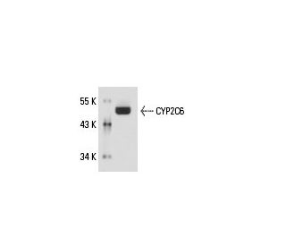 CYP2C6 Antibody (213xB12C6) - Western Blotting - Image 18138 
