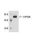 CYP2C6 Antibody (213xB12C6) - Western Blotting - Image 18138 