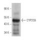 CYP2C6 Antibody (213xB12C6) - Western Blotting - Image 365633 