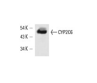 western blotting image from recommended CYP2C6 (K1) monoclonal antibody replacement. Image 13649