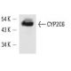 Este anticuerpo policlonal ha dejado de fabricarse. Consulta nuestro anticuerpo monoclonal recomendado <a href="cyp2c6-antibody-k1">CYP2C6 (K1)</a> (se muestran datos de muestra). western blotting image from recommended CYP2C6 (K1) monoclonal antibody replacement. Image 13649