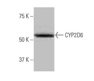 CYP2D6 Antibody (2K6) - Western Blotting - Image 53852