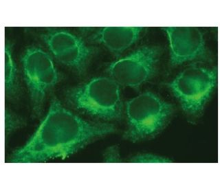 CYP2J2 Antibody (E-6) - Immunofluorescence - Image 114145 