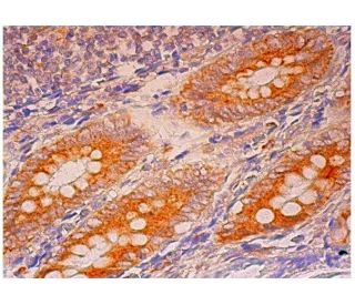 CYP2U1 Antibody (B-5) - Immunohistochemistry - Image 304843 