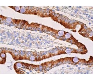 immunohistochemistry image from recommended CYP3A4 (HL3) monoclonal antibody replacement. Image 370187