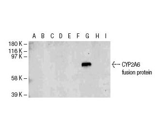 CYP3A5 Antibody (F18 P3 B6) - Western Blotting - Image 47822The Double Nickase Plasmid features a U6 promoter for sgRNA expression, a 20 nt targeting sequence, and a gRNA scaffold to guide Cas9n. It includes a CBh promoter for Cas9n (D10A) and puromycin resistance, GFP for transfection verification, and nuclear localization signals (NLS). The 2A peptide allows co-expression of Cas9n and Puro from a single promoter, enabling precise genome editing with reduced off-target effects. 
