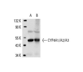 CYP4A1/A2/A3 Antibody (clo4) - Western Blotting - Image 13507 