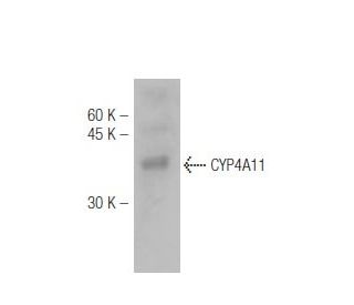 CYP4A11 Antibody (M25-P2A10) - Western Blotting - Image 47831