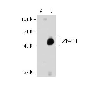 CYP4F11 Antibody (F21 P6 F5) - Western Blotting - Image 30010 