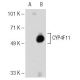 CYP4F11 Antibody (F21 P6 F5) - Western Blotting - Image 30010 