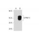 CYP4F11 Antibody (F21 P6 F5) - Western Blotting - Image 59568 