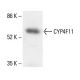 CYP4F11 Antibody (F21 P6 F5) - Western Blotting - Image 411890
