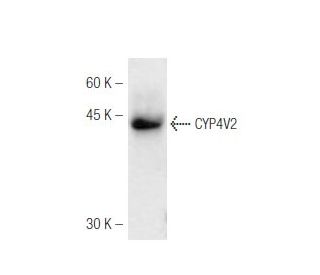 CYP4V2 Antibody (M29-P3B10) - Western Blotting - Image 47832