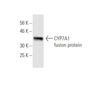 CYP7A1 Antibody (8F1) - Western Blotting - Image 348465