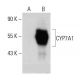 CYP7A1 Antibody (E-10) - Western Blotting - Image 385348