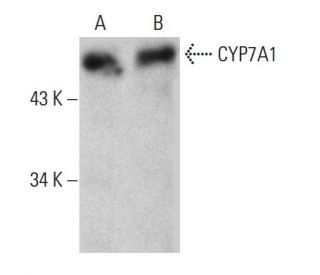 western blotting image from recommended CYP7A1 (E-10) monoclonal antibody replacement. Image 387987