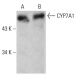 western blotting image from recommended CYP7A1 (E-10) monoclonal antibody replacement. Image 387987