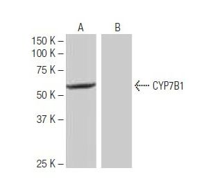 CYP7B1 Antibody (WW-H9) - Western Blotting - Image 64903SAM Transcription Activation: SAM system utilizing dCas9-VP64, MS2-P65-HSF1, and sgRNA for precise gene transcription activation.