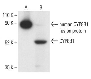 CYP8B1 Antibody (M15-P3B7) - Western Blotting - Image 401904 