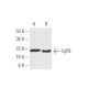 CyPB Antibody (k2E2) - Western Blotting - Image 47892 