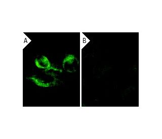 cytochrome P450 reductase siRNA (h): sc-35147. Immunofluorescence staining of methanol-fixed, control HeLa (A) and cytochr 
