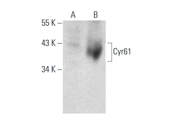 cyr61-antibody-h-2-western-