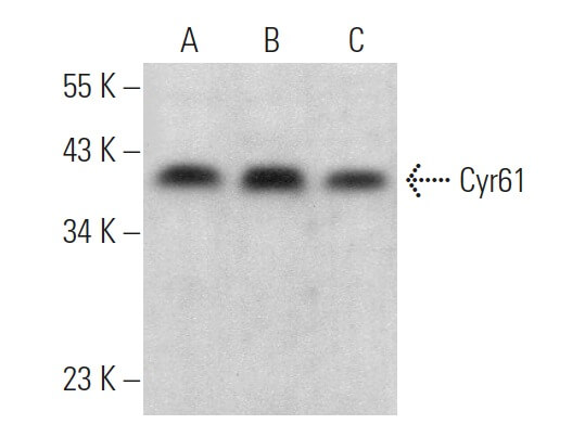 X様 cyr61-antibody-h-2-western-