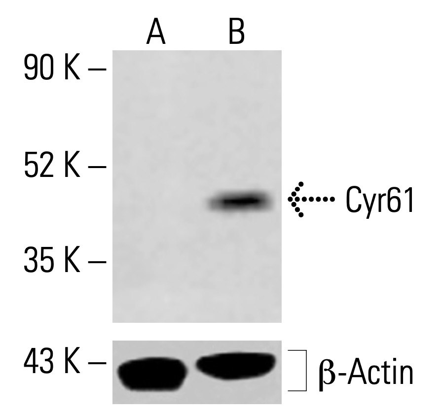 X様 Cyr61/CCN1 Antibody (H-2) | SCBT - Santa Cruz Biotechnology