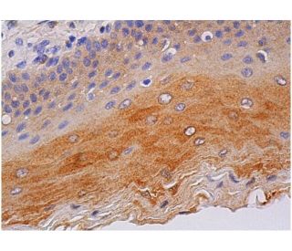 immunohistochemistry image from recommended Cyr61/CCN1 (A-10) monoclonal antibody replacement. Image 361366