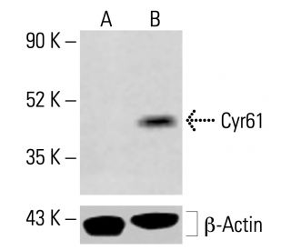 Cyr61/CCN1 Antibody (H-2) - Western Blotting - Image 413914
